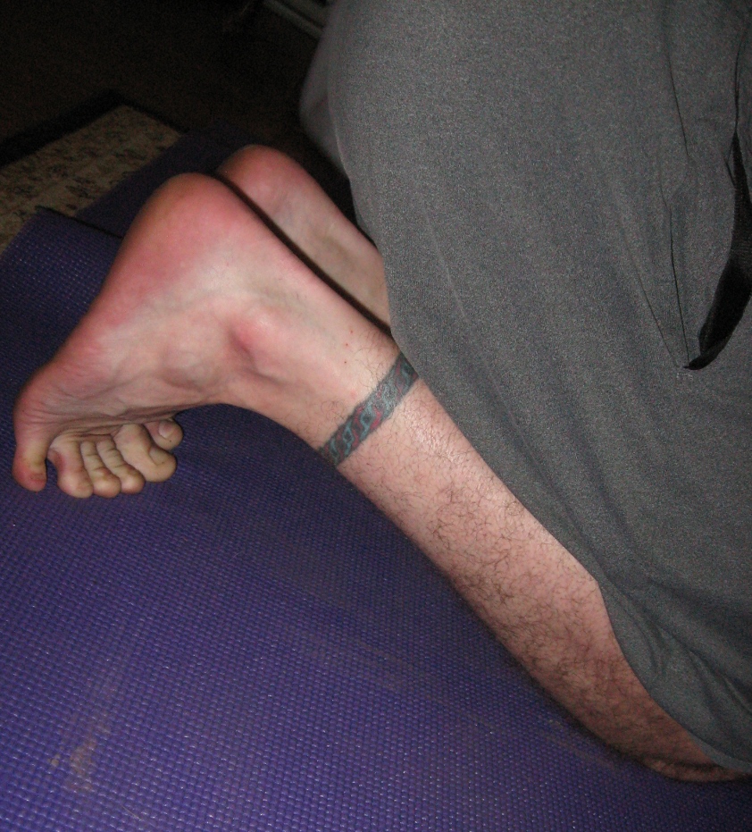 Barefoot with all toes tucked under
